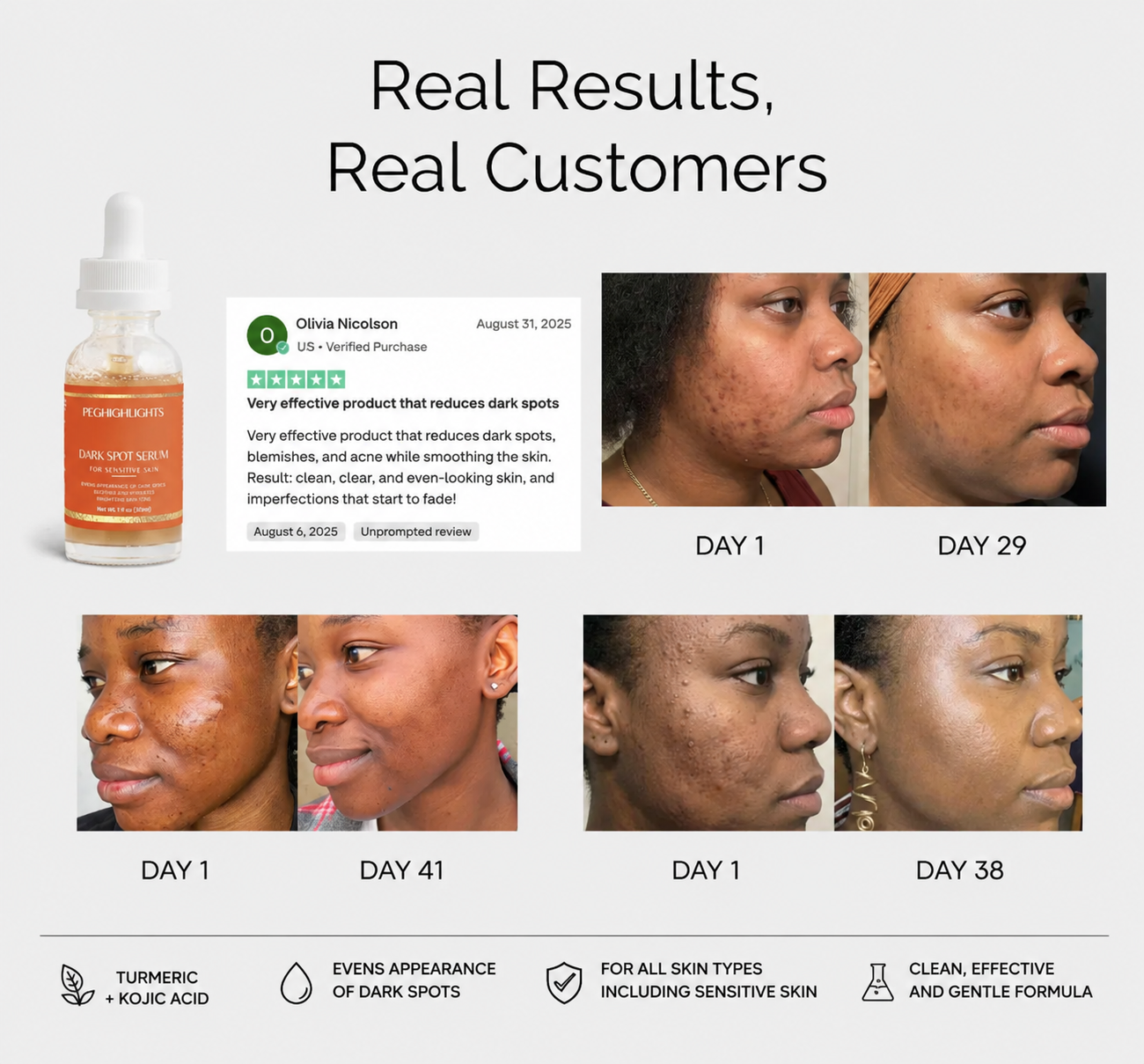 Dark Spot Serum for Sensitive Skin