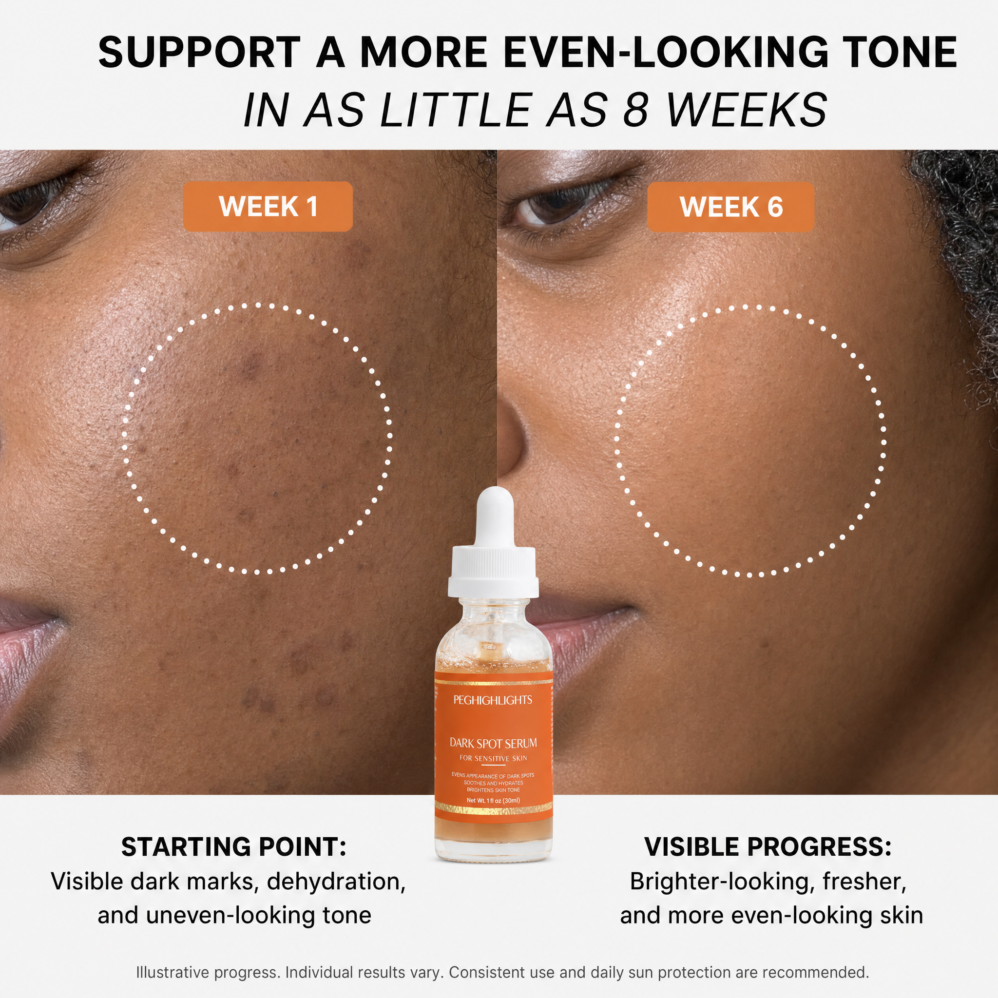 Dark Spot Serum for Sensitive Skin